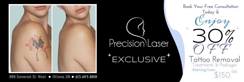 ... Laser Spa | Ottawa | Luxury Facials | Hair Removal » Tattoo Removal